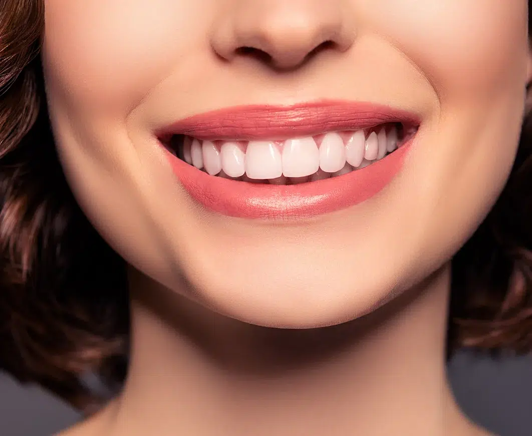 dental veneers South Austin Dental Veneers in Austin