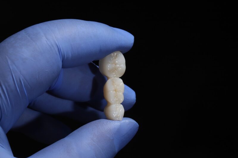 Dental Bridges Austin